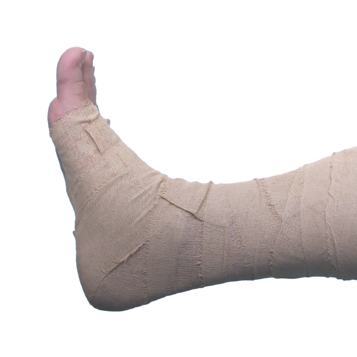 Benda medicata all'ossido di zinco ICHTHOPASTE - 7,5 cm x 6 mt