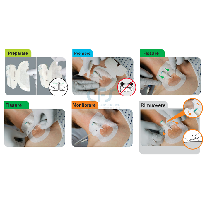 Medicazione adesiva sterile per fissaggio 3M TEGADERM I.V. ADVANCED cm 8,5 x 11,5 (conf. 50 pz.)