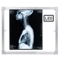 Negativoscopio 36 x 42 a LED con cassonetto
